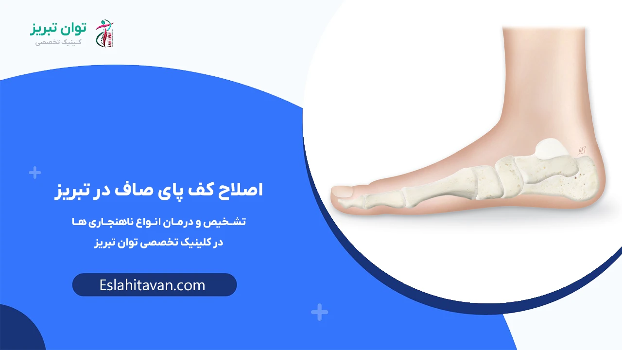 اصلاح-کف-پای-صاف-در-تبریز