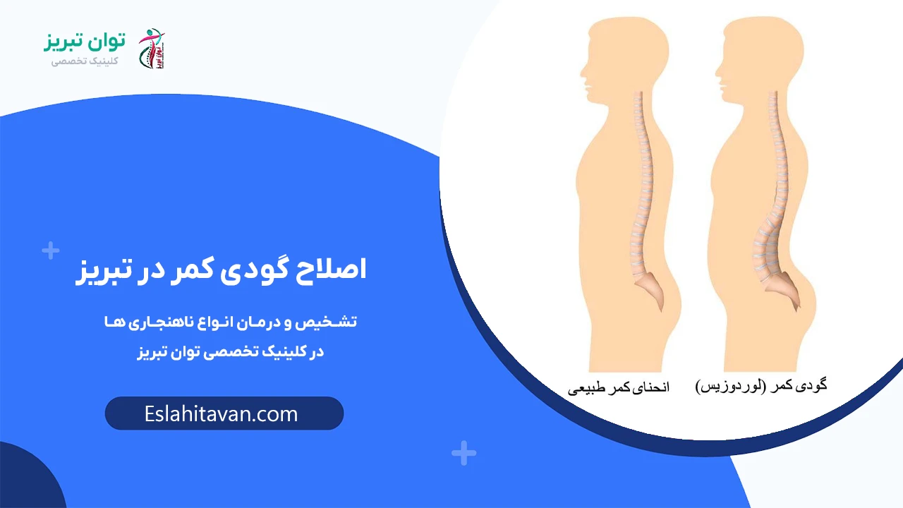 گودی-کمر