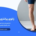 زانوی پرانتزی چیست؟